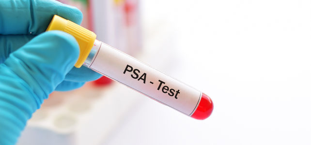 Der PSAWert Vorreiter der individualisierten Früherkennung